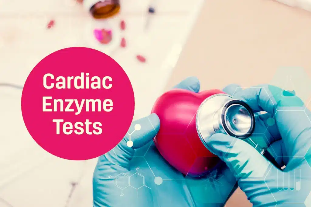 Cardiac Enzyme Test Understanding Its Purpose Normal Range