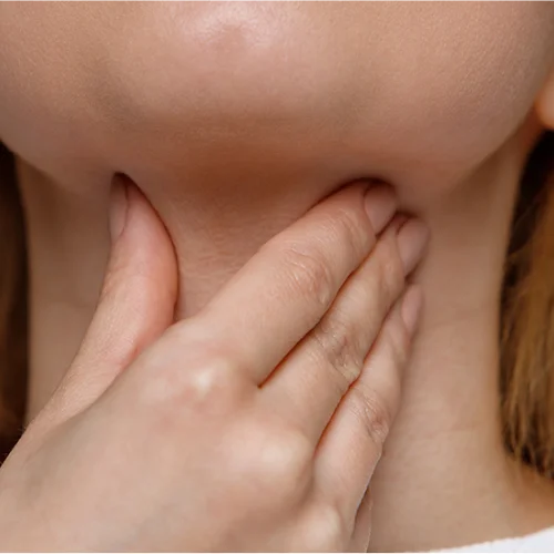 Strep-Throat-Symptoms