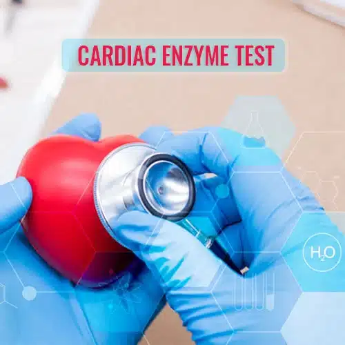 cardiac enzyme test bedford tx