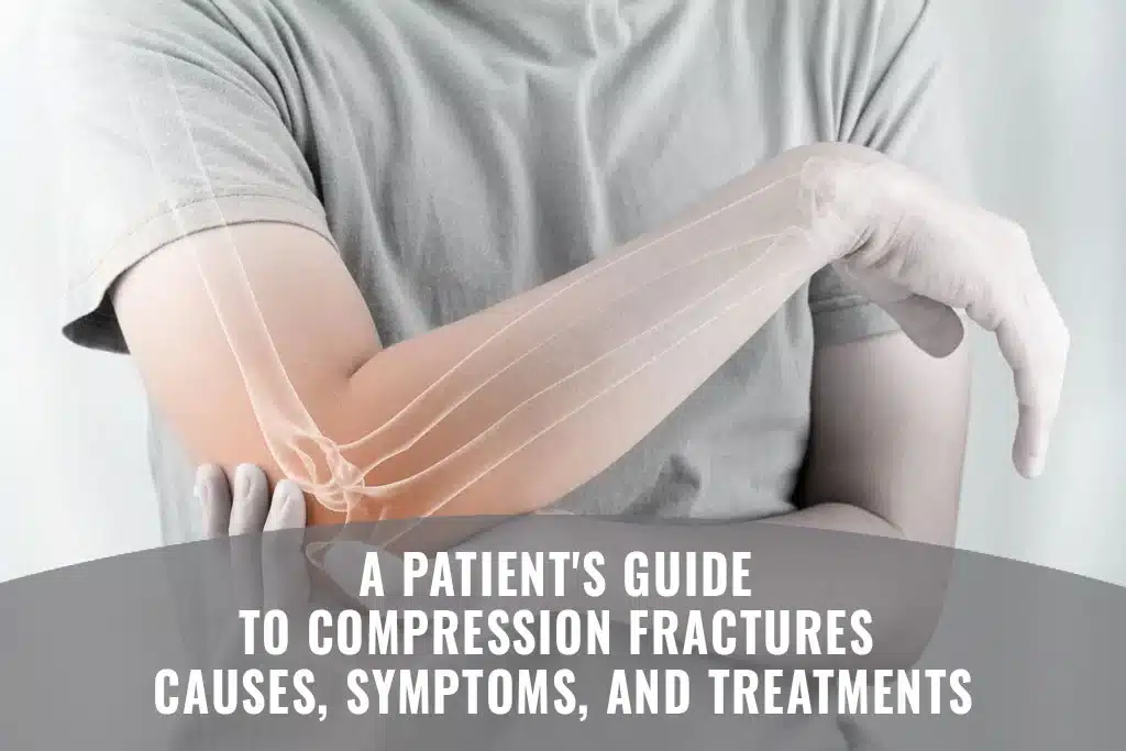 A Patients Guide to Compression Fractures Causes, Symptoms, and Treatments
