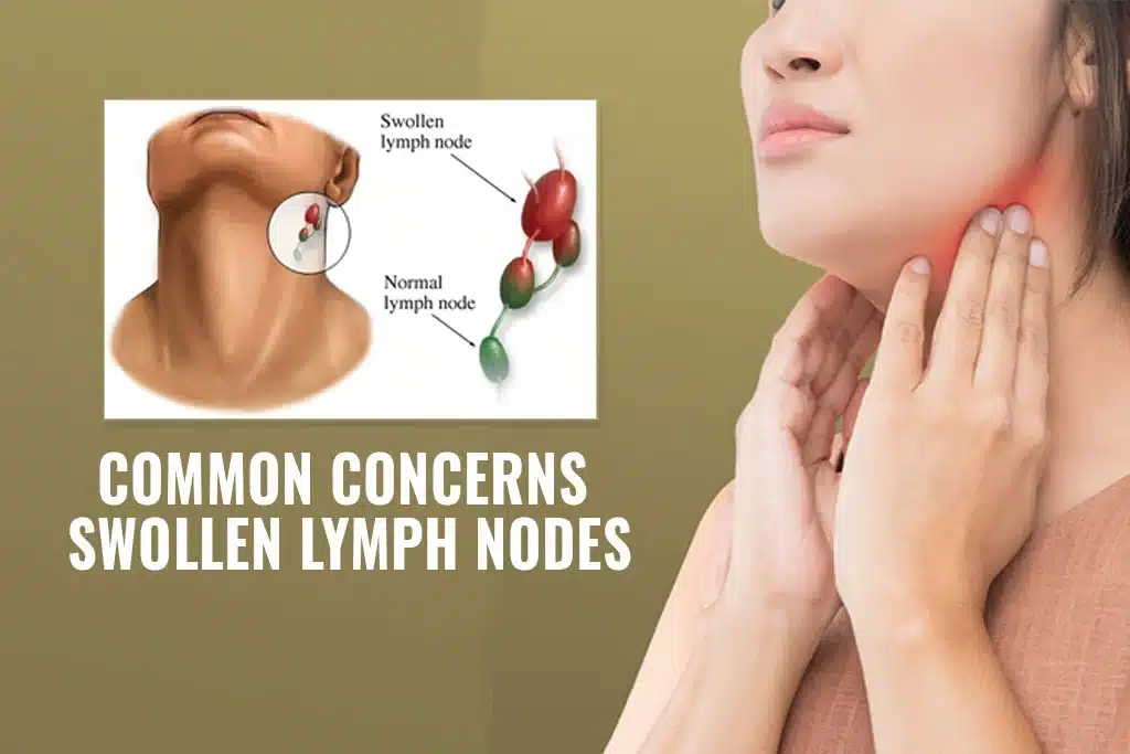 Crucial Role Of Lymph Nodes Insights Into Immune Function