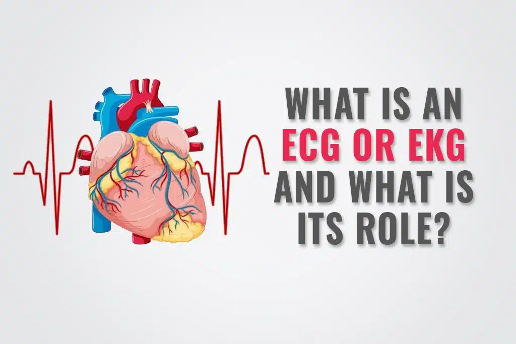 What is an ECG or EKG and what is its role