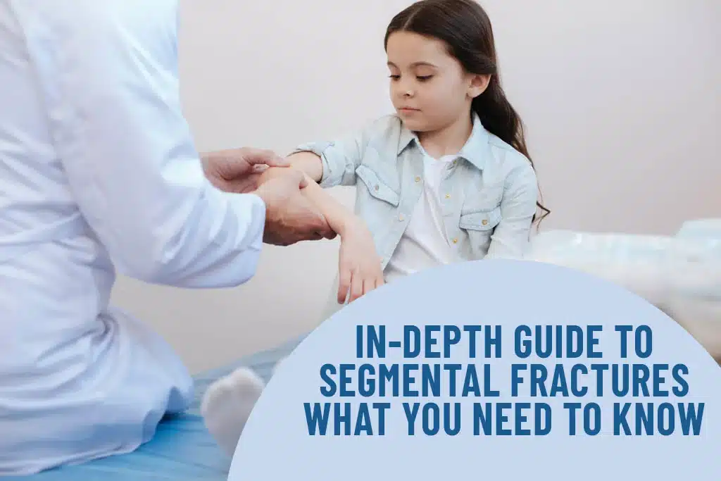 In-depth Guide to Segmental Fractures: What You Need to Know