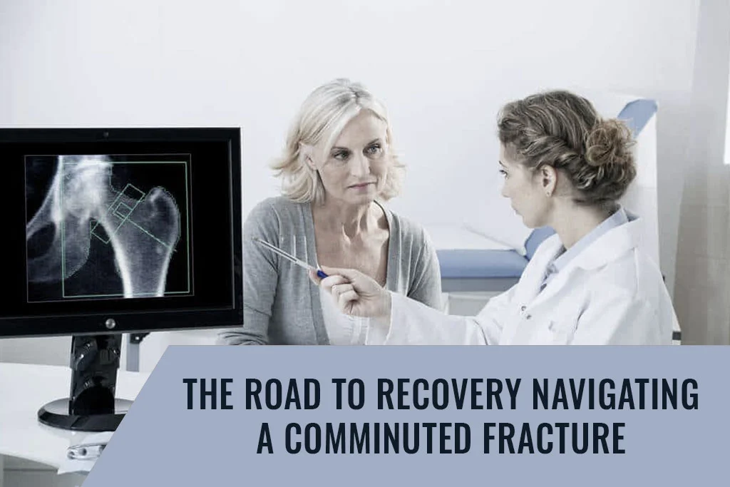 The Road to Recovery: Navigating a Comminuted Fracture