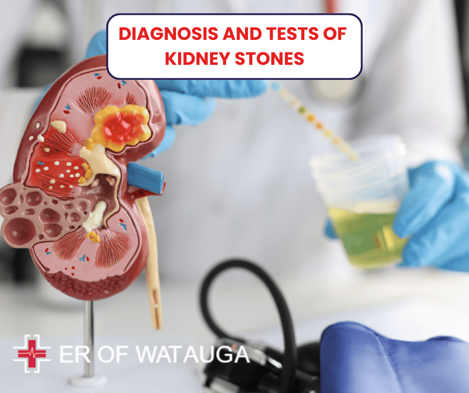 Diagnosis and Tests of Kidney Stones Near Me Emergency Room ER OF WATAUGA