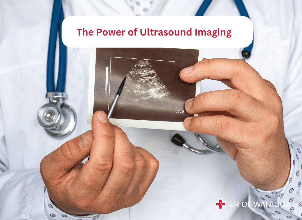 The Power of Ultrasound Imaging - ER of Watauaga TX near me