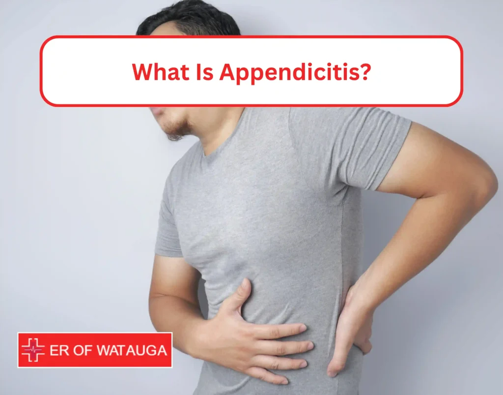 What Is Appendicitis