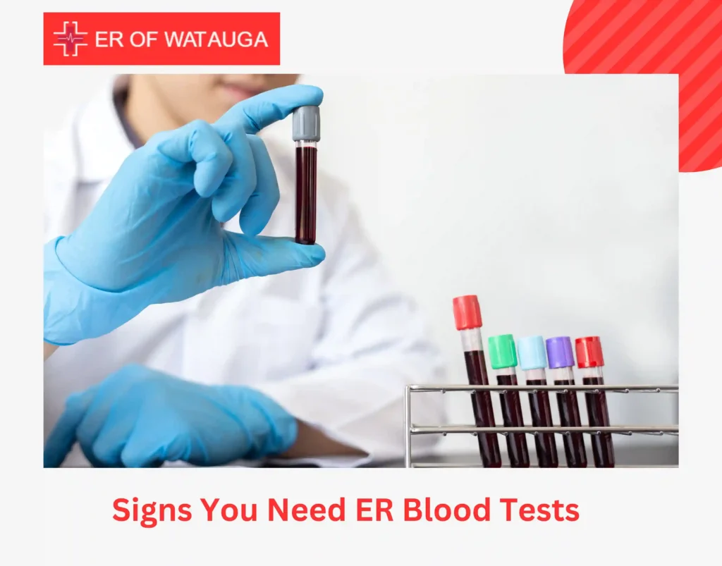 Signs You Need ER Blood Tests