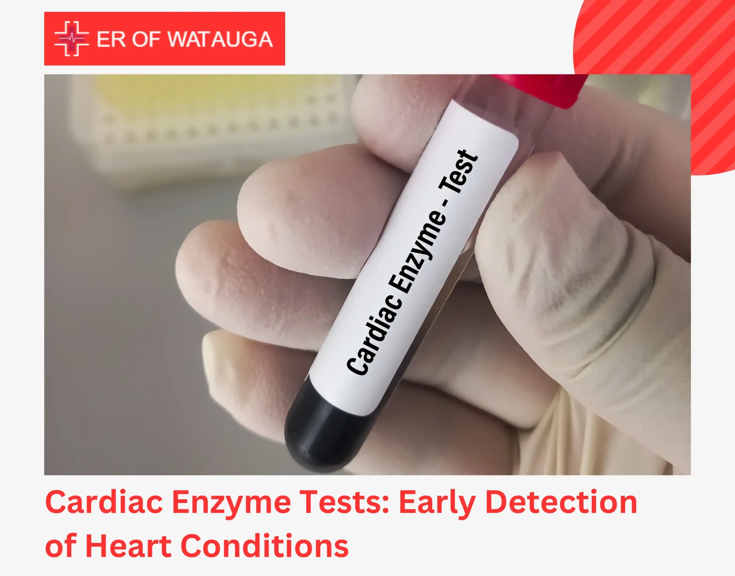 Cardiac Enzyme Tests Early Detection of Heart Conditions