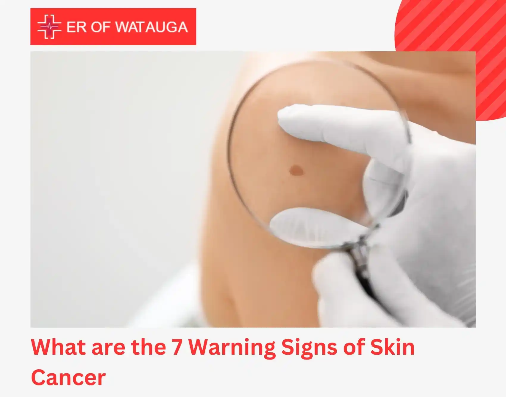 What are the 7 Warning Signs of Skin Cancer