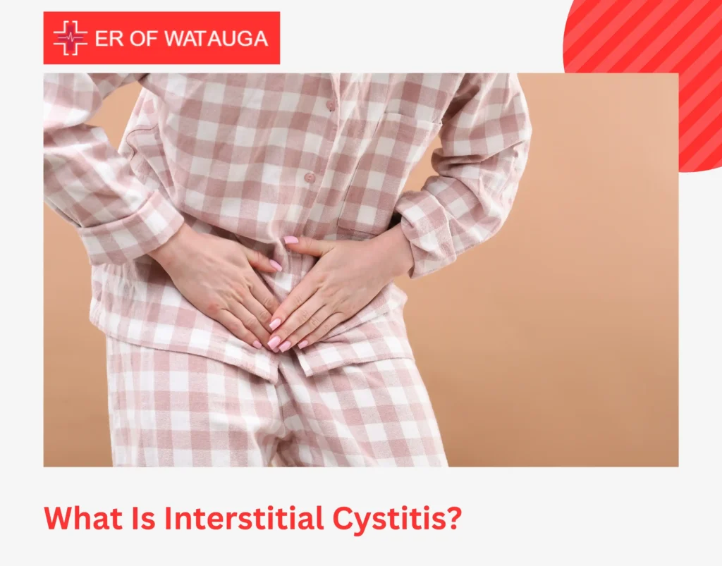 What Is Interstitial Cystitis