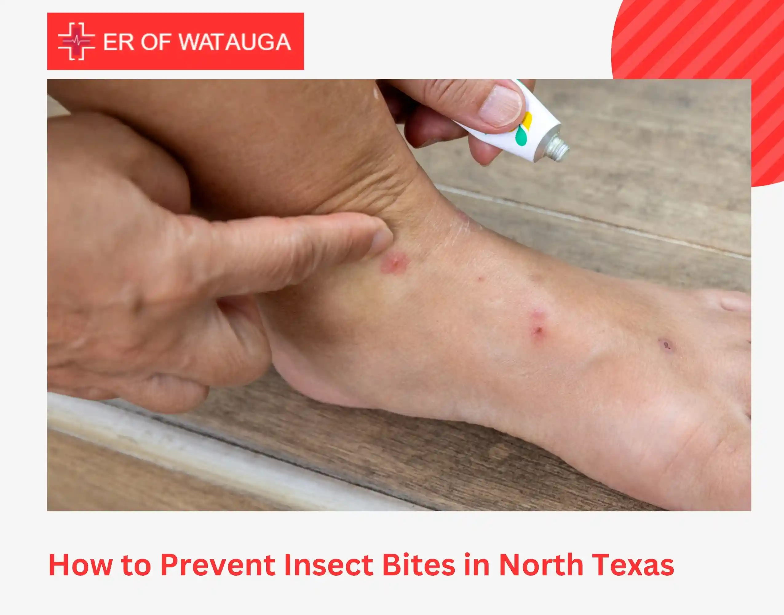 How to Prevent Insect Bites in North Texas