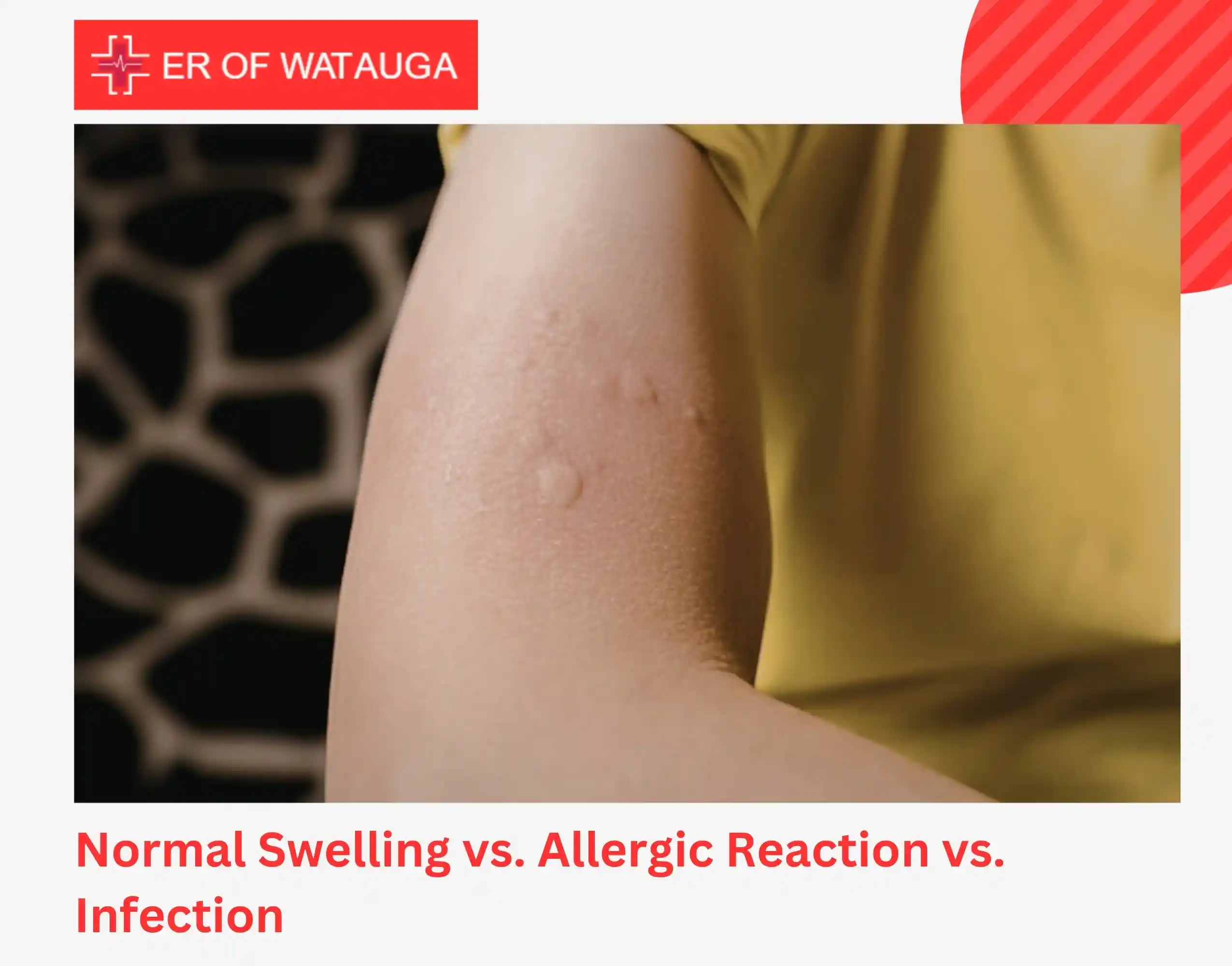 Normal Swelling vs. Allergic Reaction vs. Infection