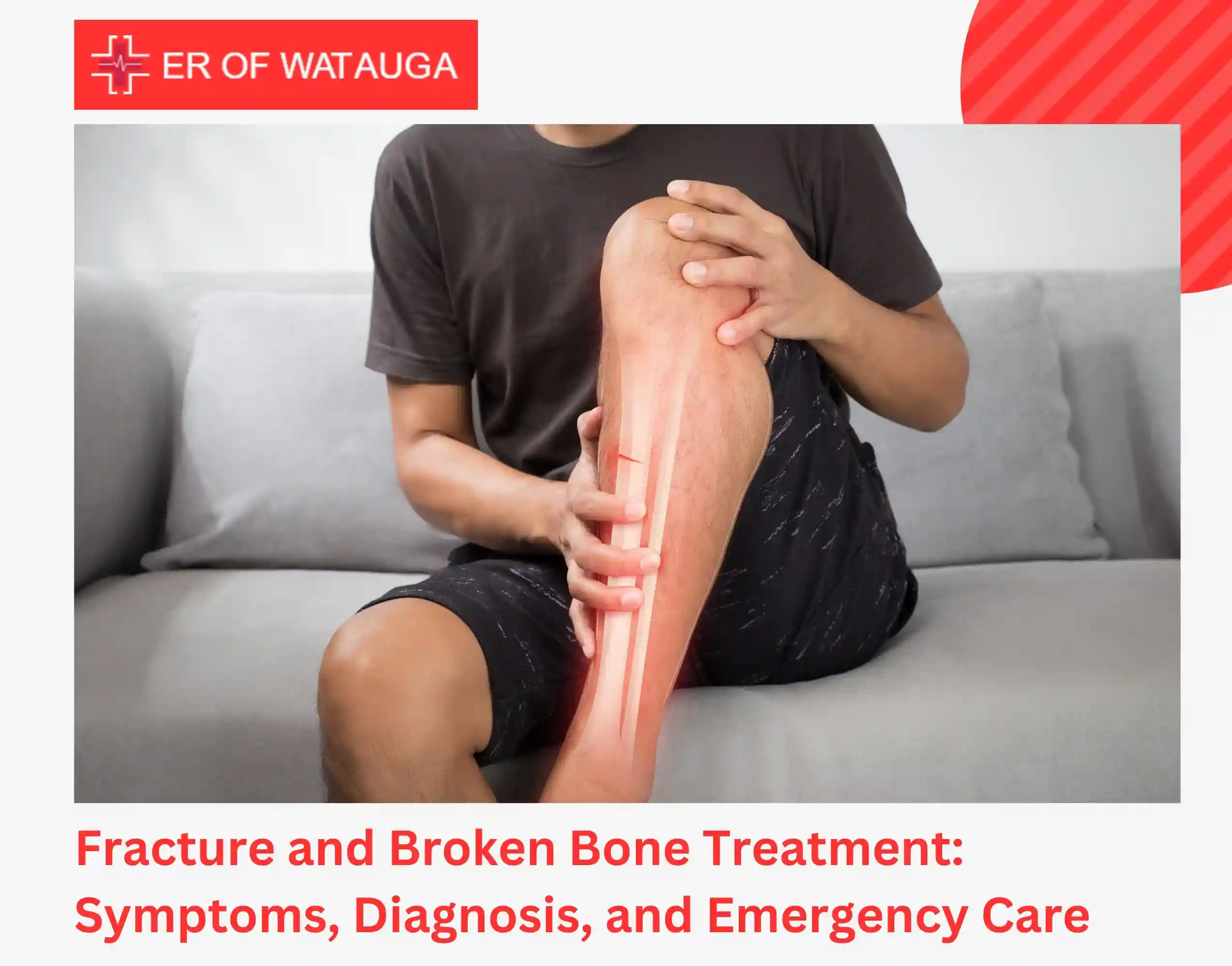 Fracture and Broken Bone Treatment Symptoms, Diagnosis, and Emergency Care