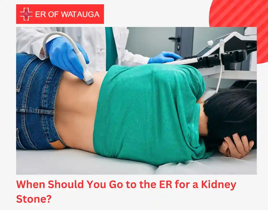 When Should You Go to the ER for a Kidney Stone