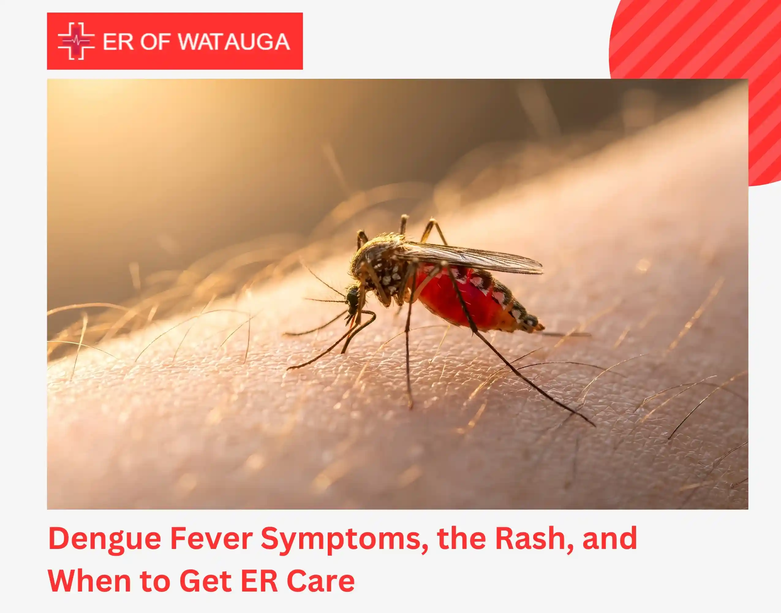 Dengue Fever Symptoms, the Rash, and When to Get ER Care