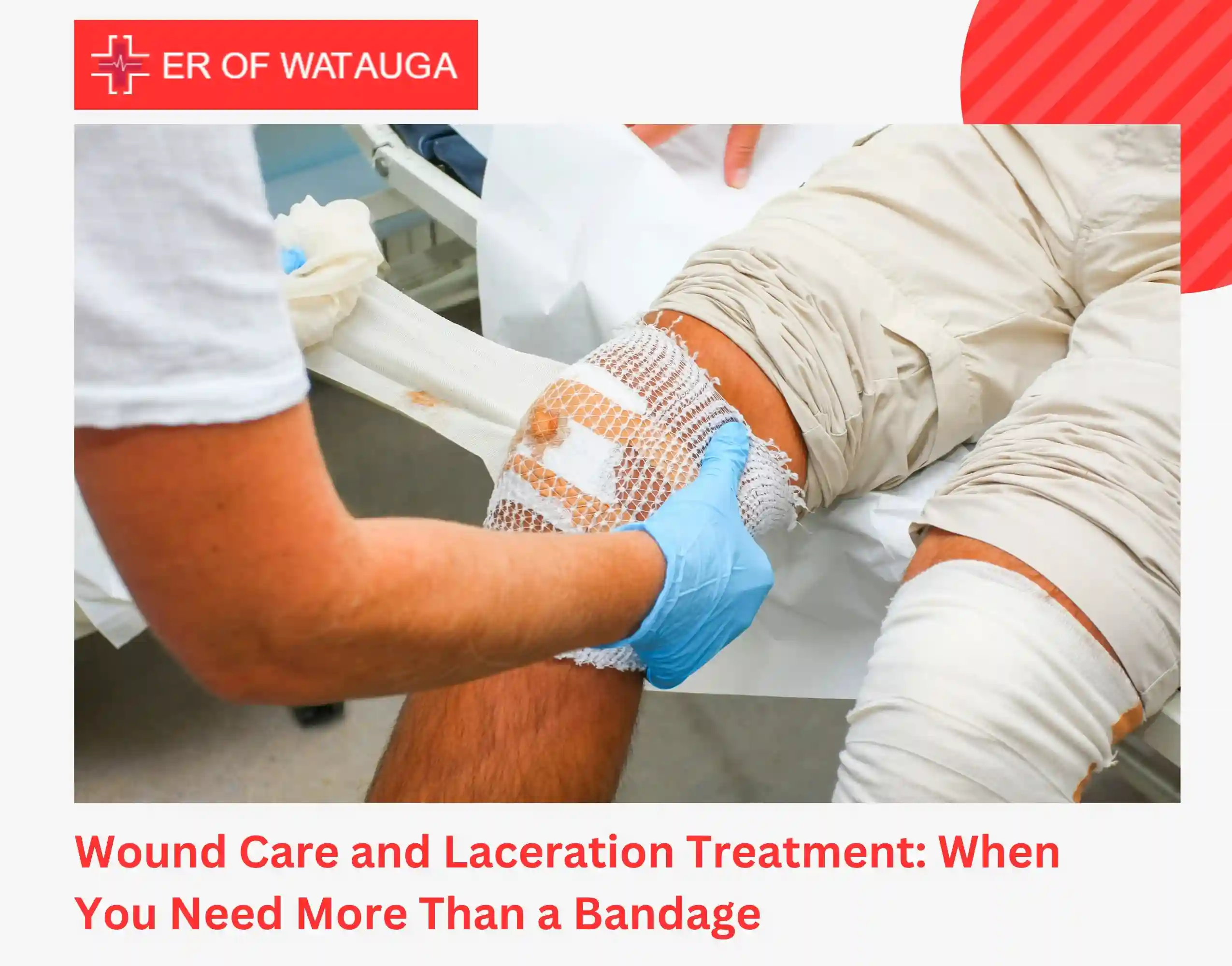 Wound Care and Laceration Treatment When You Need More Than a Bandage