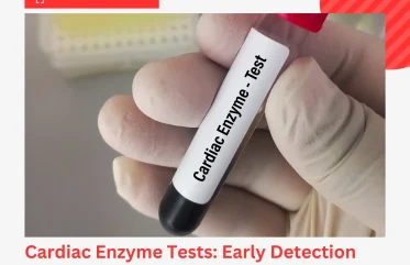 Cardiac Enzyme Tests Early Detection of Heart Conditions