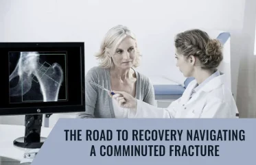 The Road to Recovery: Navigating a Comminuted Fracture